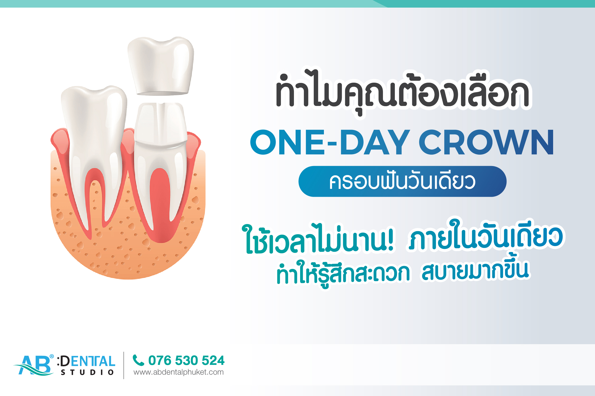 one day crown,deantal crown,deantal crown phuket,one day crown phuket,dental phuket,ab dental phuket,ab dental