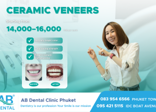 Transform your smile in just one day with premium Ceramic Veneers.