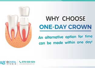 AB Dental Clinic Phuket…“One-Day Crown. 🦷” An alternative option for time consuming and conveniences.