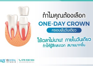 AB Dental Clinic Phuket “One-Day Crown.” ตัวเลือกในด้านการปกป้องให้ฟันของคุณแข็งแรง