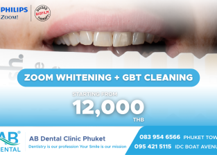 Whitening + GBT = สูตรยิ้มขาวสะอาดในวันเดียว!