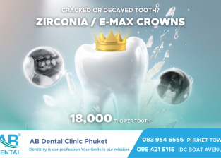 Don’t Extract It Yet! A Dental Crown Can Help.