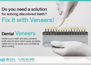 Do you need a solution for solving discolored teeth? Fix it with Veneers!