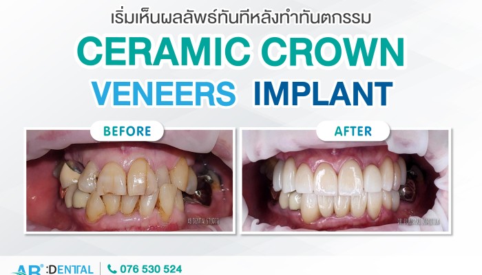 คลินิกทันตกรรม,คลินิกจัดฟัน, คลินิก จัด ฟัน ภูเก็ต, คลินิกทำฟัน ภูเก็ต, dental clinic, dental clinic phuket, phuket dental clinic, dental clinic near me