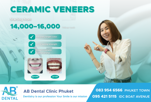 Transform your smile in just one day with premium Ceramic Veneers.