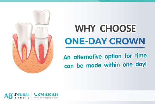 AB Dental Clinic Phuket…“One-Day Crown. 🦷” An alternative option for time consuming and conveniences.