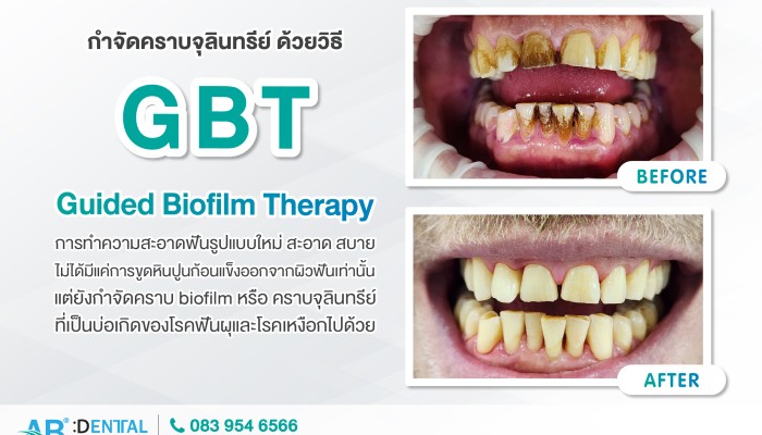 คลินิกทันตกรรม,คลินิกจัดฟัน, คลินิก จัด ฟัน ภูเก็ต, คลินิกทำฟัน ภูเก็ต, dental clinic, dental clinic phuket, phuket dental clinic, dental clinic near me