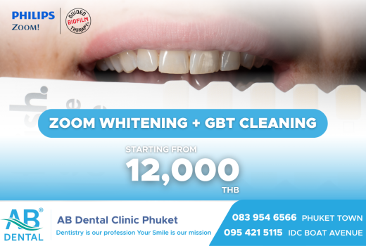 Whitening + GBT = สูตรยิ้มขาวสะอาดในวันเดียว!
