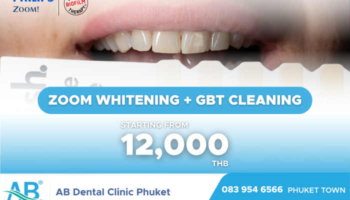 คลินิกทันตกรรม,คลินิกจัดฟัน, คลินิก จัด ฟัน ภูเก็ต, คลินิกทำฟัน ภูเก็ต, dental clinic, dental clinic phuket, phuket dental clinic, dental clinic near me