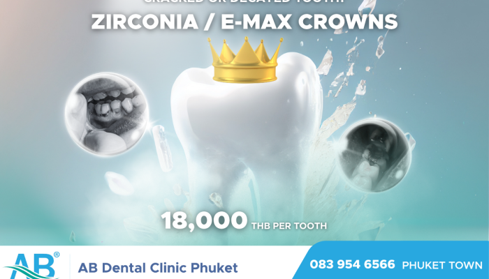 คลินิกทันตกรรม,คลินิกจัดฟัน, คลินิก จัด ฟัน ภูเก็ต, คลินิกทำฟัน ภูเก็ต, dental clinic, dental clinic phuket, phuket dental clinic, dental clinic near me