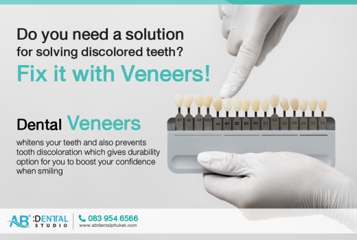 Do you need a solution for solving discolored teeth?Fix it with Veneers!