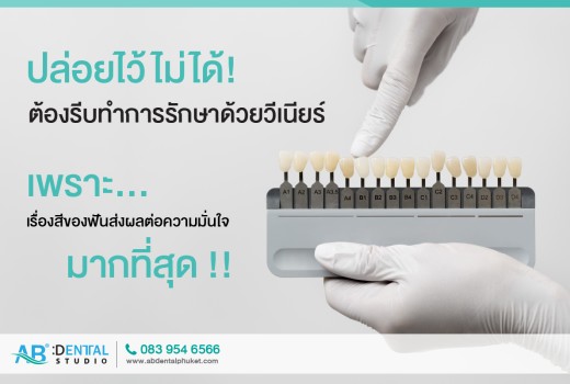 ปล่อยไว้ไม่ได้! ต้องรีบทำการรักษาด้วยวีเนียร์ เพราะ…เรื่องสีของฟันส่งผลต่อความมั่นใจ มากที่สุด