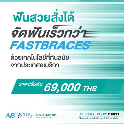 คลินิกทันตกรรม,คลินิกจัดฟัน, คลินิก จัด ฟัน ภูเก็ต, คลินิกทำฟัน ภูเก็ต, dental clinic, dental clinic phuket, phuket dental clinic, dental clinic near me, จัด ฟัน invisalign, dental veneer, ทําฟันปลอมที่ไหนดี, filling teeth, invisalign, crowns dental, ฟันปลอม, ฟอกสีฟัน, ฟอกฟันขาว, teeth whitening, รักษารากฟัน